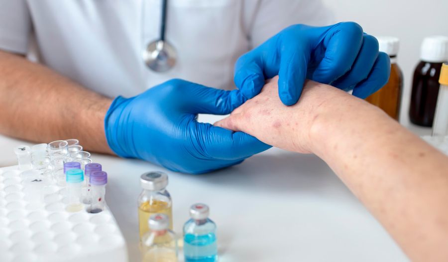 Allergy Specialists in Dubai